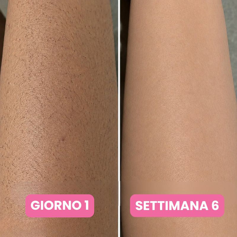 Siero anti-ricrescita peli: Non serve più radersi ogni due giorni
