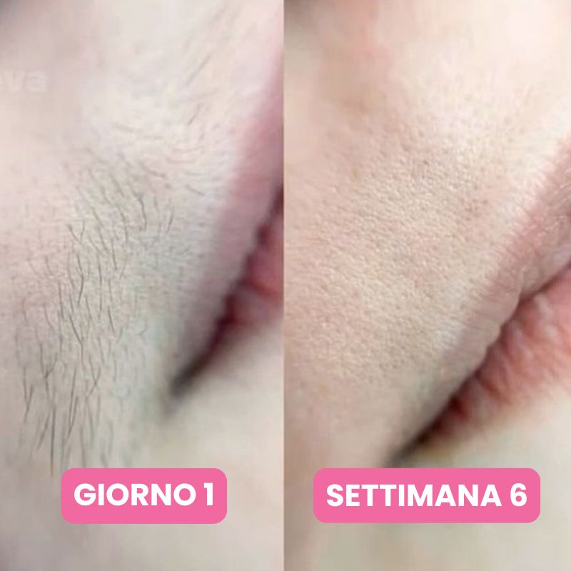 Siero anti-ricrescita peli: Non serve più radersi ogni due giorni