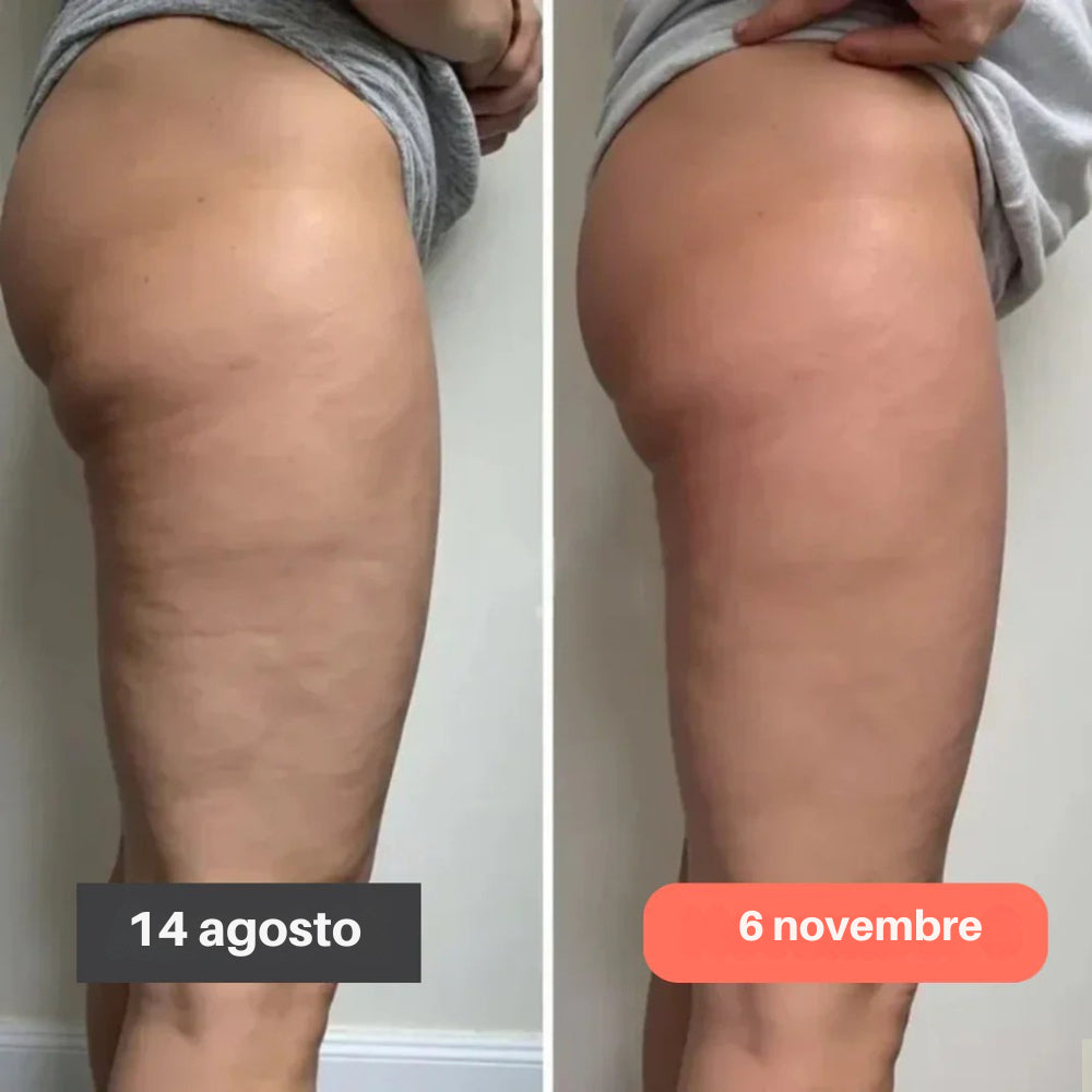 Leggings 3D Purelya – Ridefinisci la tua silhouette senza sforzo