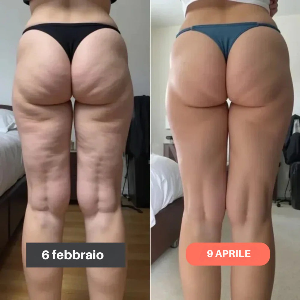 La Culotte Modellante Anticellulite 3 IN 1: Drena, modella e aiuta a bruciare calorie